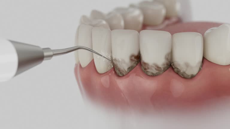 Trusted Emergency Dentist service in Mission, KS - Dentist Open Now